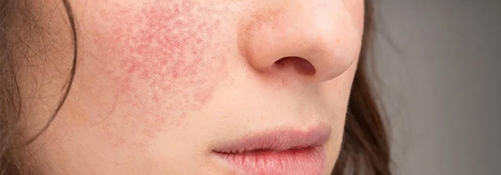 Winter dryness: How can temperature and humidity sensors help us adjust indoor humidity?